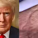 Trump Diagnosed with Vein Disorder – White House Confirms