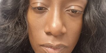 Can Dyslexia Be Cured?